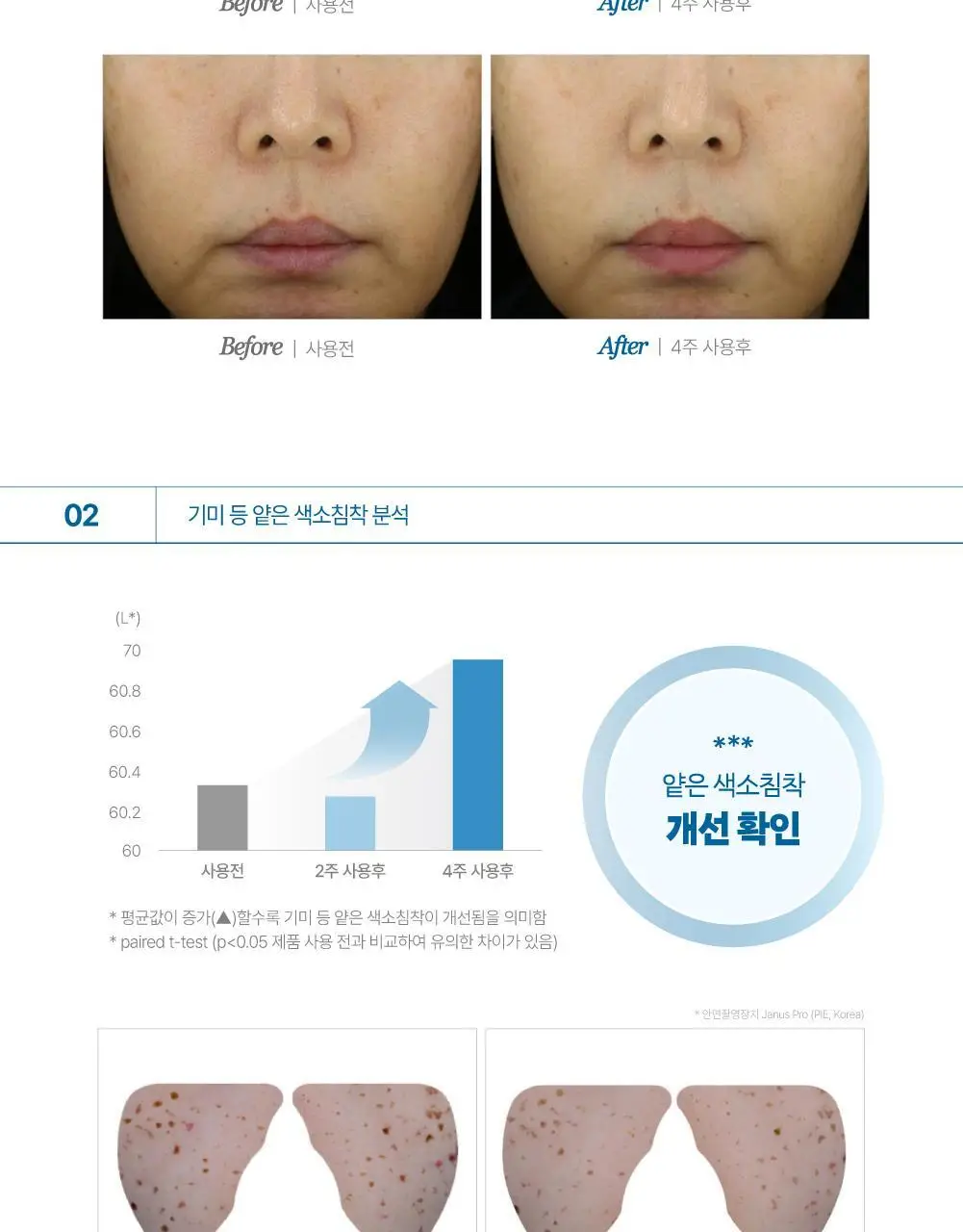 [리뷰이벤트] 라보타치 다크스팟 케어 패치 32매 상세페이지 31